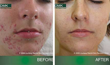 DMK - Advanced Paramedical Skin Revision and Skincare Products