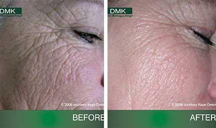 DMK - Advanced Paramedical Skin Revision and Skincare Products