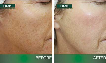 DMK - Advanced Paramedical Skin Revision and Skincare Products