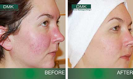 DMK - Advanced Paramedical Skin Revision and Skincare Products